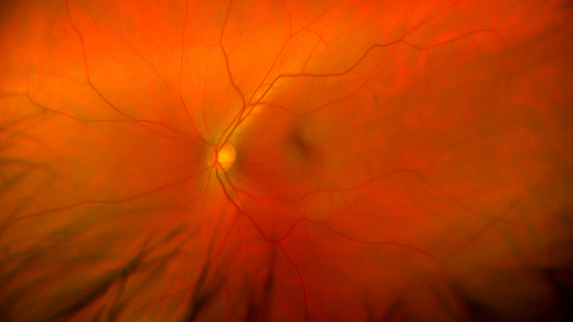 View inside of the human eye showing a healthy retina, optic nerve, and macula.